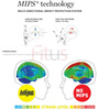 SMITH ZIP JR MIPS Kask Rowerowy YELLOW  YS 48-52